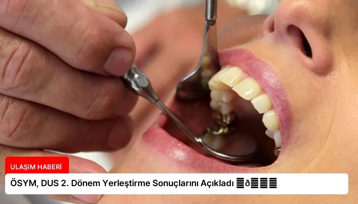ÖSYM, DUS 2. Dönem Yerleştirme Sonuçlarını Açıkladı ⏬👇
